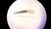 Demodex folliculorum, nużeniec ludzki