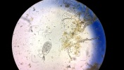 Balantidium sp. (trofozoit 2) w kale żółwia greckiego