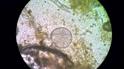 Balantidium sp. (trofozoit 1) w kale żołwia greckiego