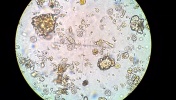 Oocysty Toxoplasma gondii w kale kota