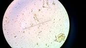 Giardia intestinalis w kale szynszyli