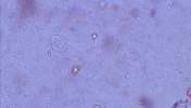 Entamoeba sp. w kale węża boa