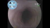 Gastroskopia kota - Anatomia