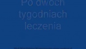 Syndrom Wobblera u Doga Niemieckiego
