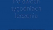 Syndrom Wobblera u Doga Niemieckiego