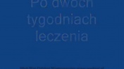 Syndrom Wobblera u Doga Niemieckiego